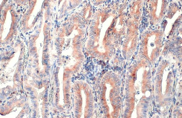 CD74 Antibody in Immunohistochemistry (Paraffin) (IHC (P))