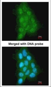 MAGEA11 Antibody in Immunocytochemistry (ICC/IF)