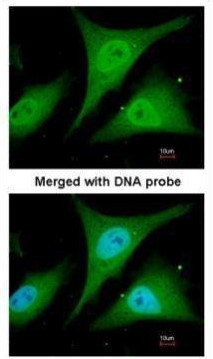 IkB alpha Antibody in Immunocytochemistry (ICC/IF)