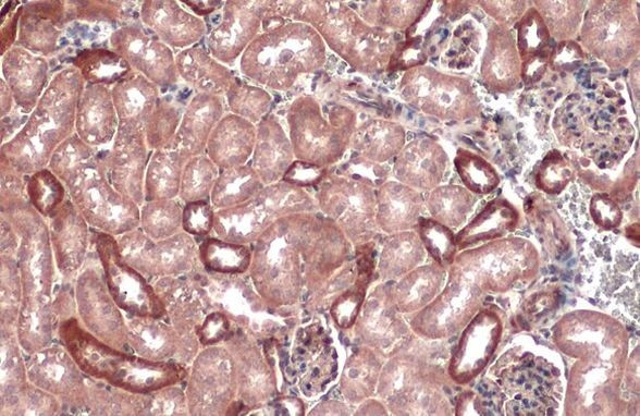 IkB alpha Antibody in Immunohistochemistry (Paraffin) (IHC (P))