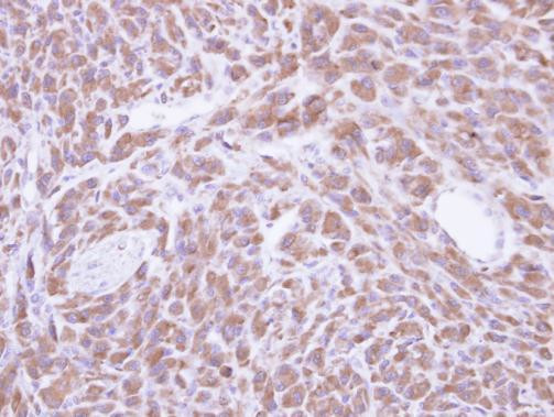 PCMT1 Antibody in Immunohistochemistry (Paraffin) (IHC (P))