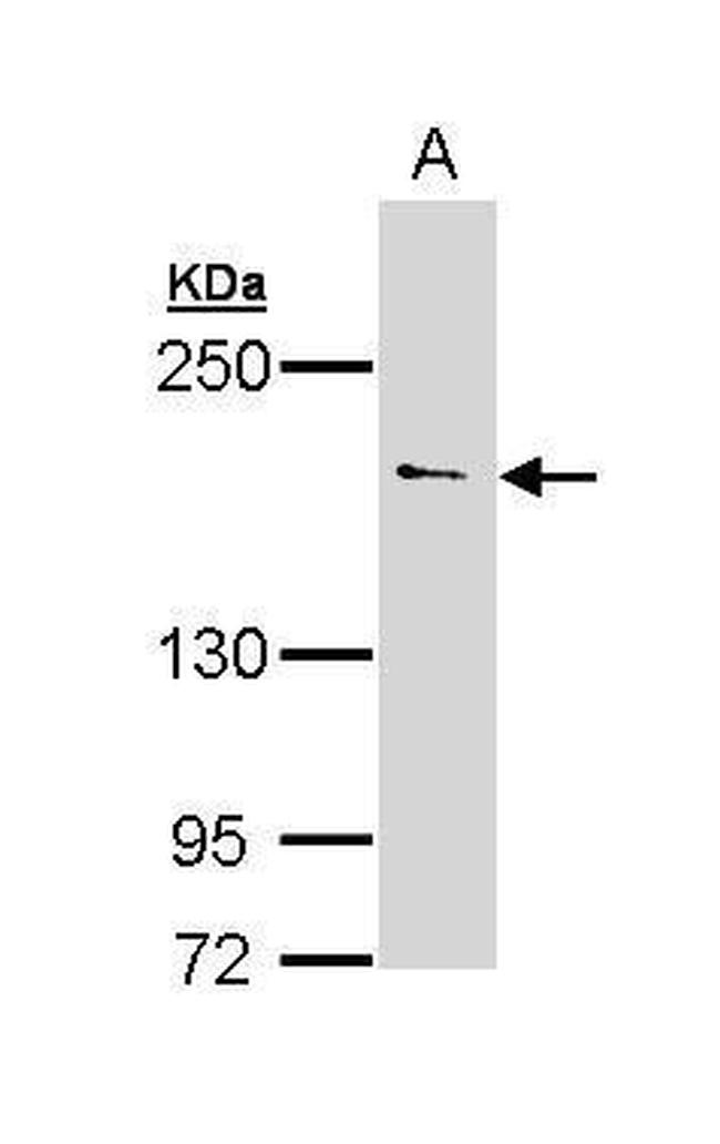 UNC13B Antibody in Western Blot (WB)