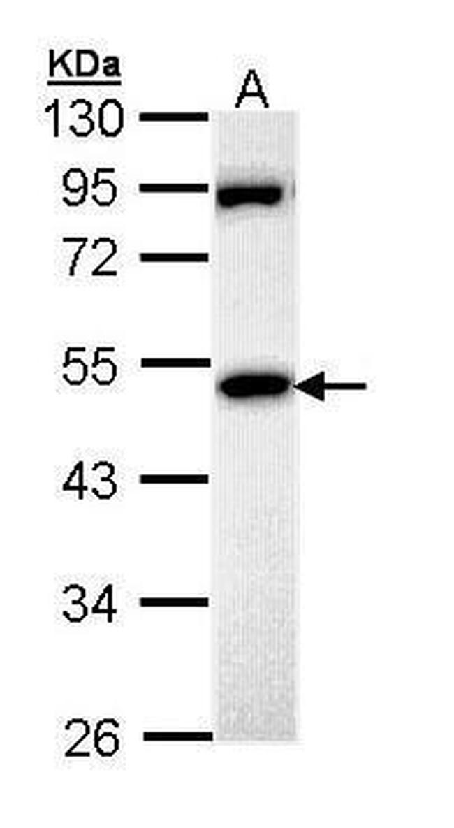 MPP1 Antibody in Western Blot (WB)