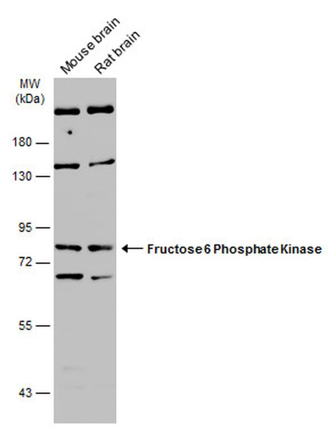 PFKM Antibody in Western Blot (WB)