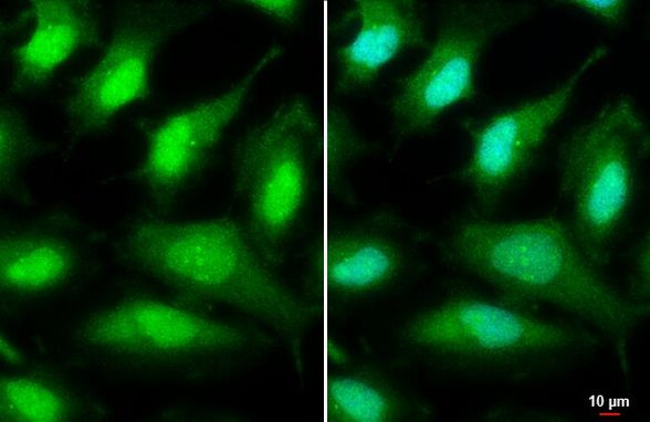 ULK2 Antibody in Immunocytochemistry (ICC/IF)