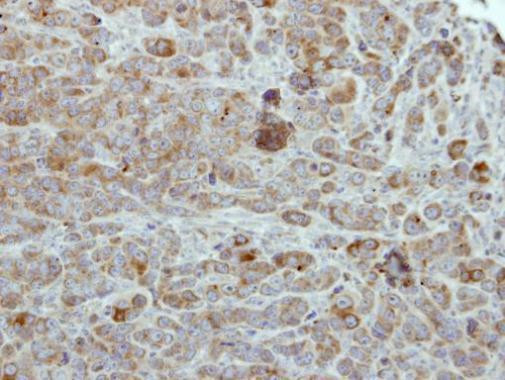 ULK2 Antibody in Immunohistochemistry (Paraffin) (IHC (P))