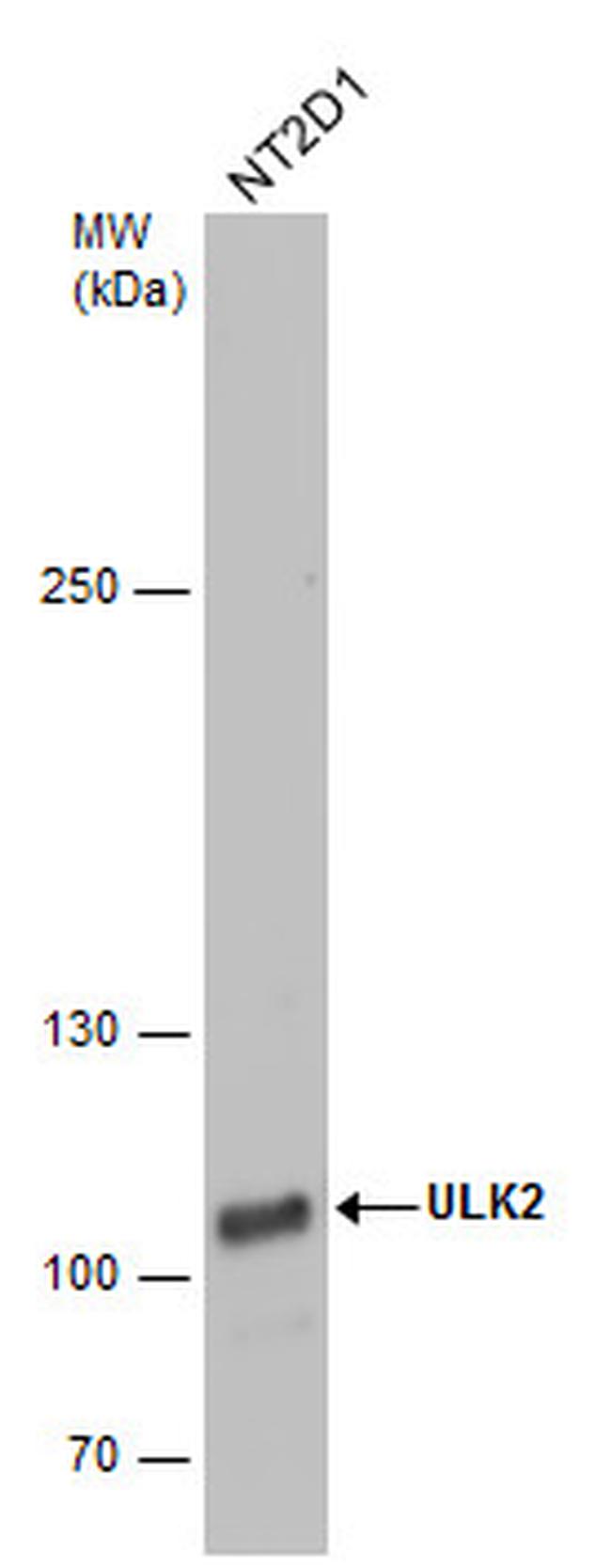 ULK2 Antibody in Western Blot (WB)