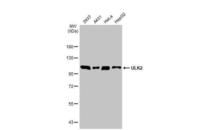 ULK2 Antibody in Western Blot (WB)