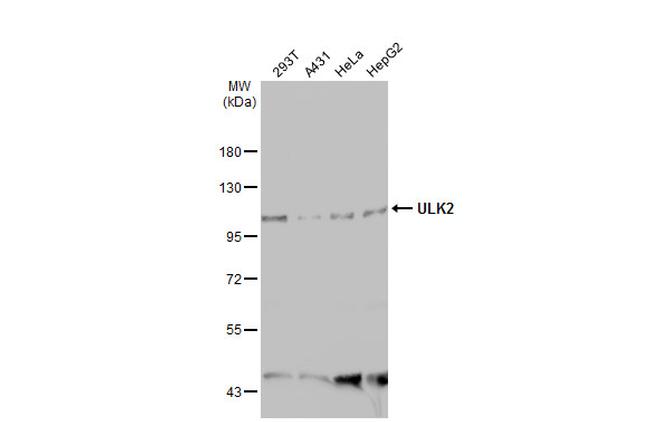 ULK2 Antibody in Western Blot (WB)