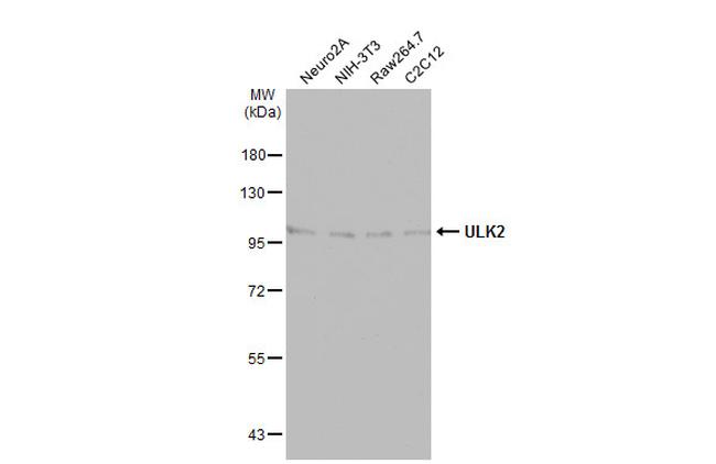 ULK2 Antibody in Western Blot (WB)