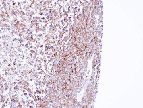 MPP1 Antibody in Immunohistochemistry (Paraffin) (IHC (P))