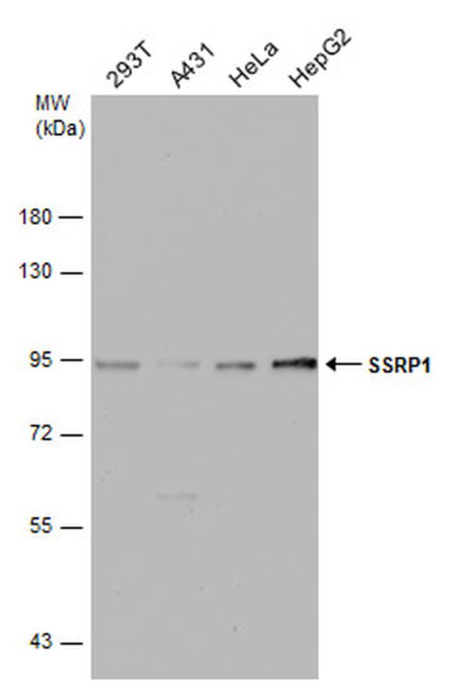 SSRP1 Antibody in Western Blot (WB)