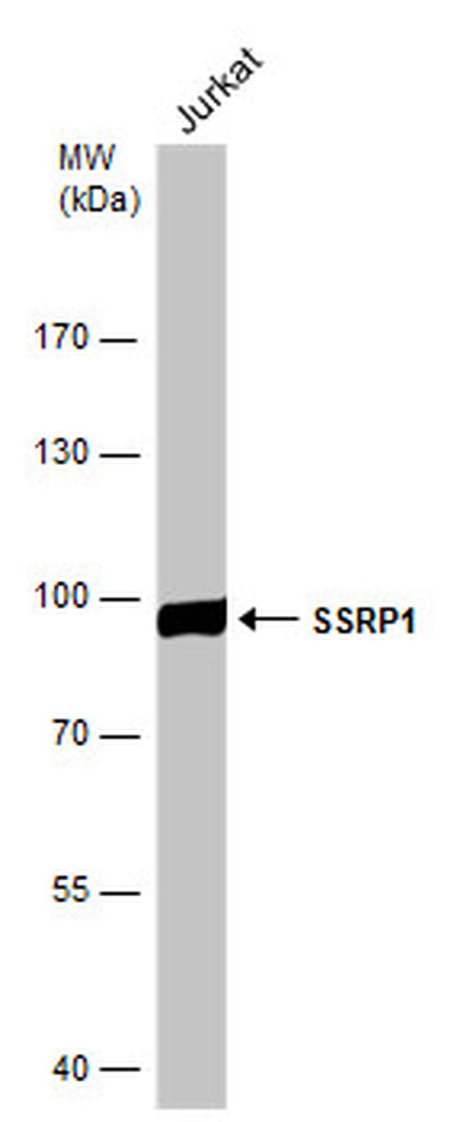 SSRP1 Antibody in Western Blot (WB)