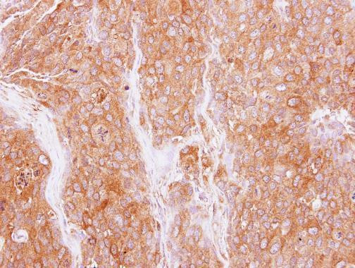 GMFB Antibody in Immunohistochemistry (Paraffin) (IHC (P))