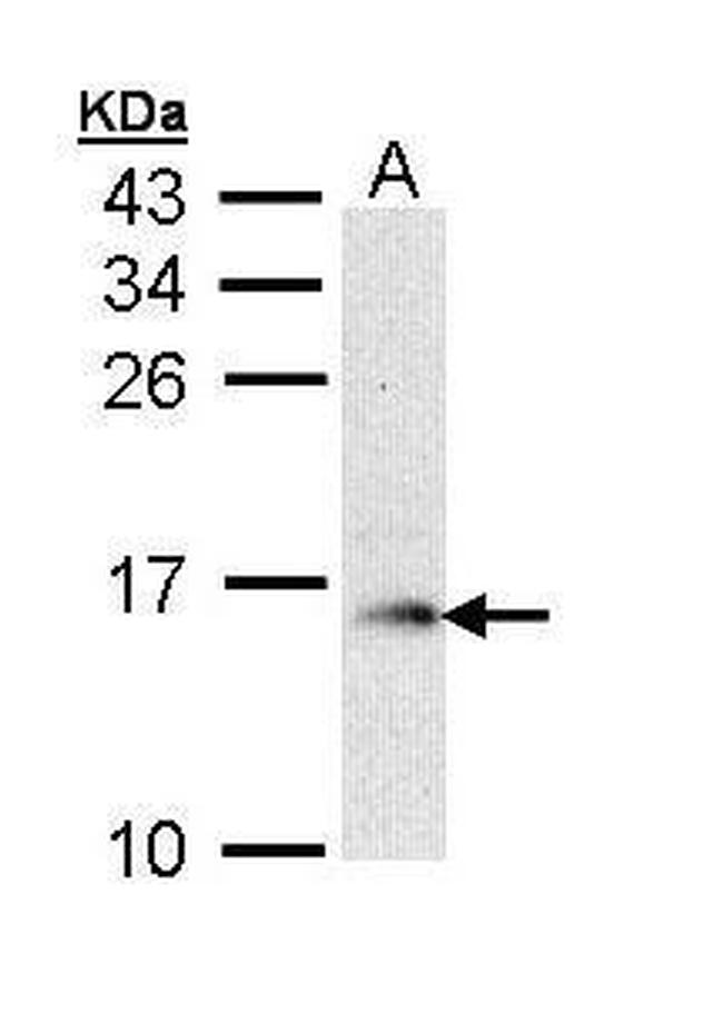 GMFB Antibody in Western Blot (WB)