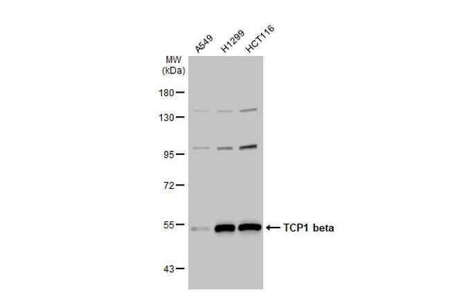 TCP-1 beta Antibody in Western Blot (WB)