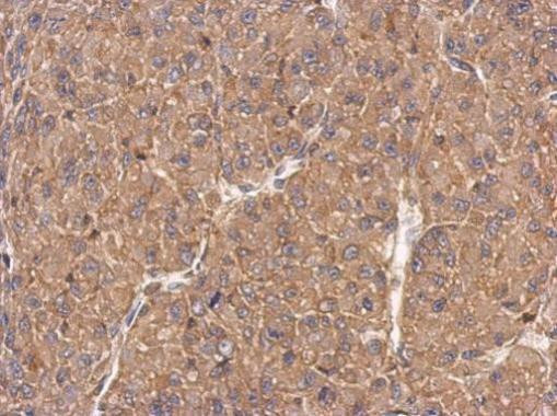 FMNL1 Antibody in Immunohistochemistry (Paraffin) (IHC (P))