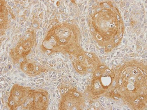 INPP5B Antibody in Immunohistochemistry (Paraffin) (IHC (P))