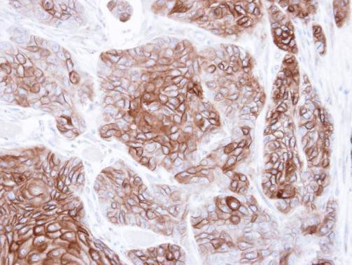 CNGA2 Antibody in Immunohistochemistry (Paraffin) (IHC (P))