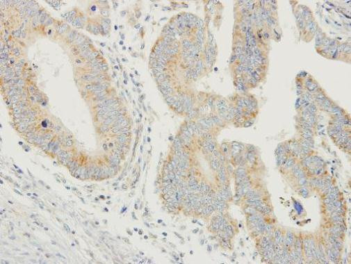 Prodynorphin Antibody in Immunohistochemistry (Paraffin) (IHC (P))