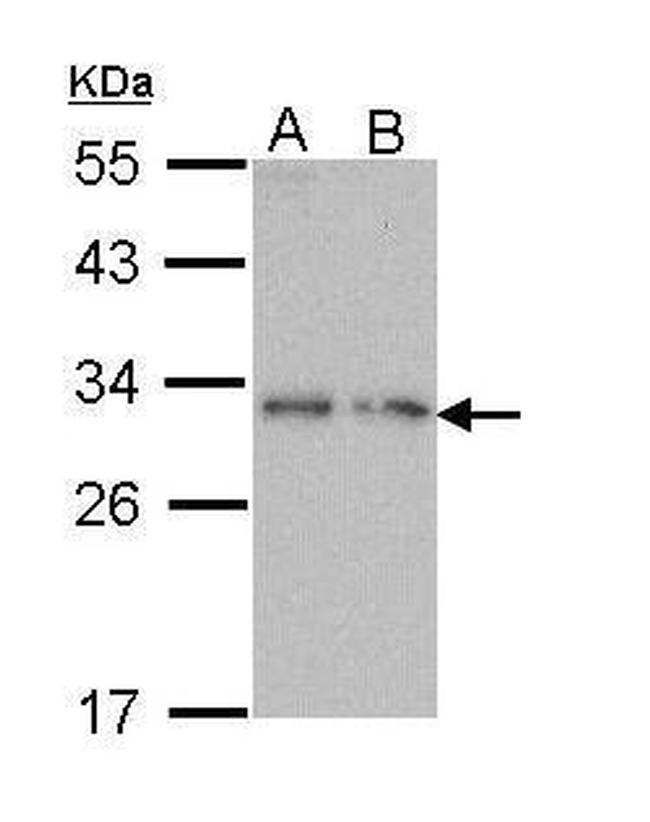 Prodynorphin Antibody in Western Blot (WB)