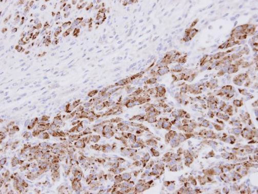 PSMA3 Antibody in Immunohistochemistry (Paraffin) (IHC (P))