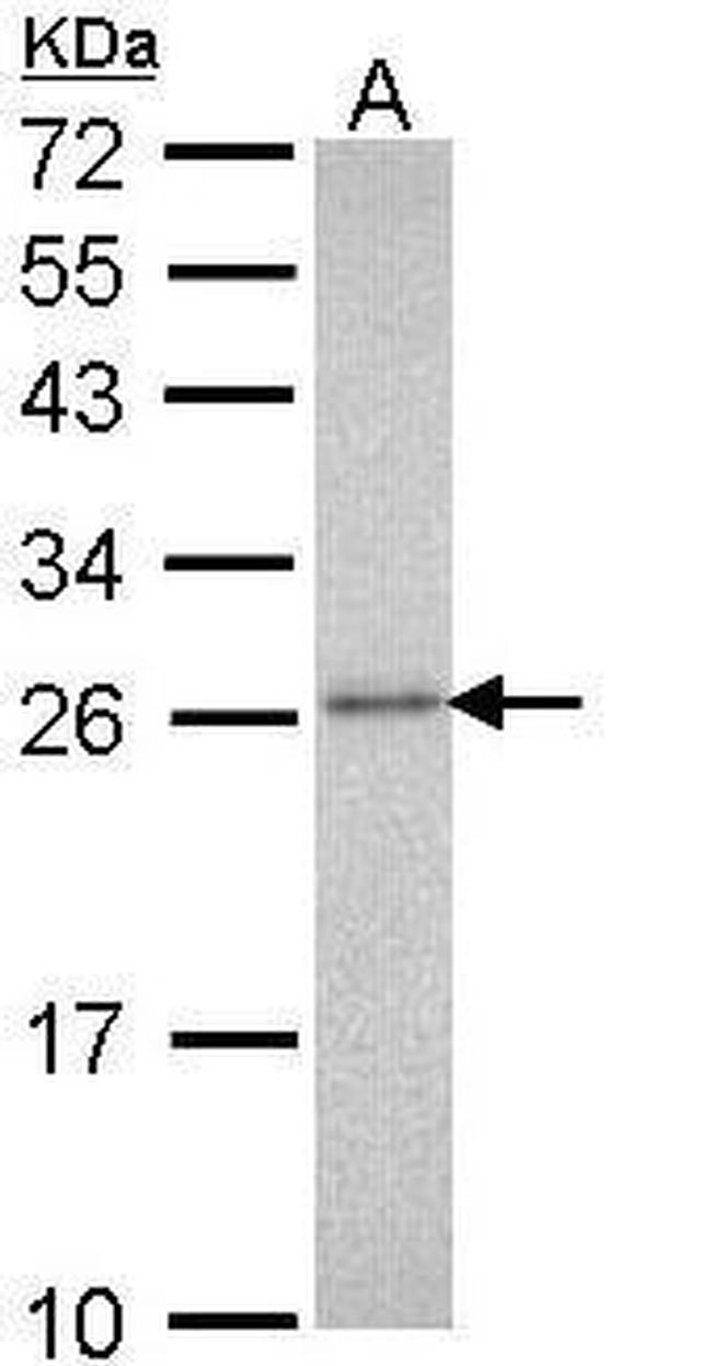 PSMA3 Antibody in Western Blot (WB)