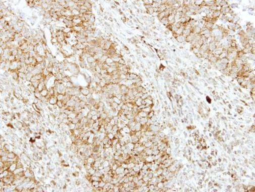 SH3GL1 Antibody in Immunohistochemistry (Paraffin) (IHC (P))