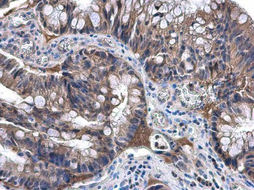 NAT1 Antibody in Immunohistochemistry (Paraffin) (IHC (P))