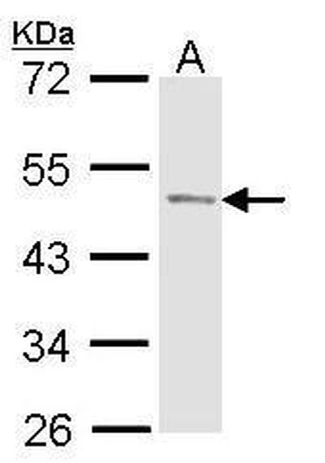 Prostate Specific Acid Phosphatase Antibody in Western Blot (WB)