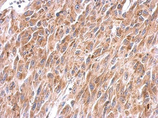 NDUFS8 Antibody in Immunohistochemistry (Paraffin) (IHC (P))