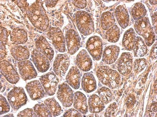 NDUFS8 Antibody in Immunohistochemistry (Paraffin) (IHC (P))