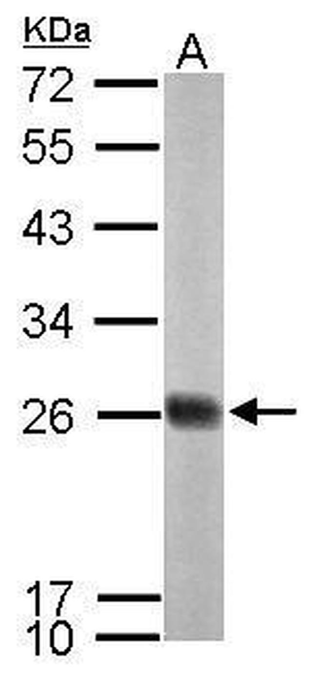 NDUFS8 Antibody in Western Blot (WB)