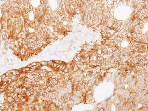 LAD1 Antibody in Immunohistochemistry (Paraffin) (IHC (P))