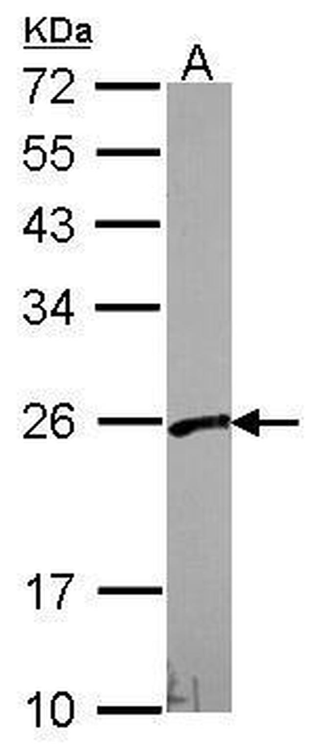 VBP1 Antibody in Western Blot (WB)