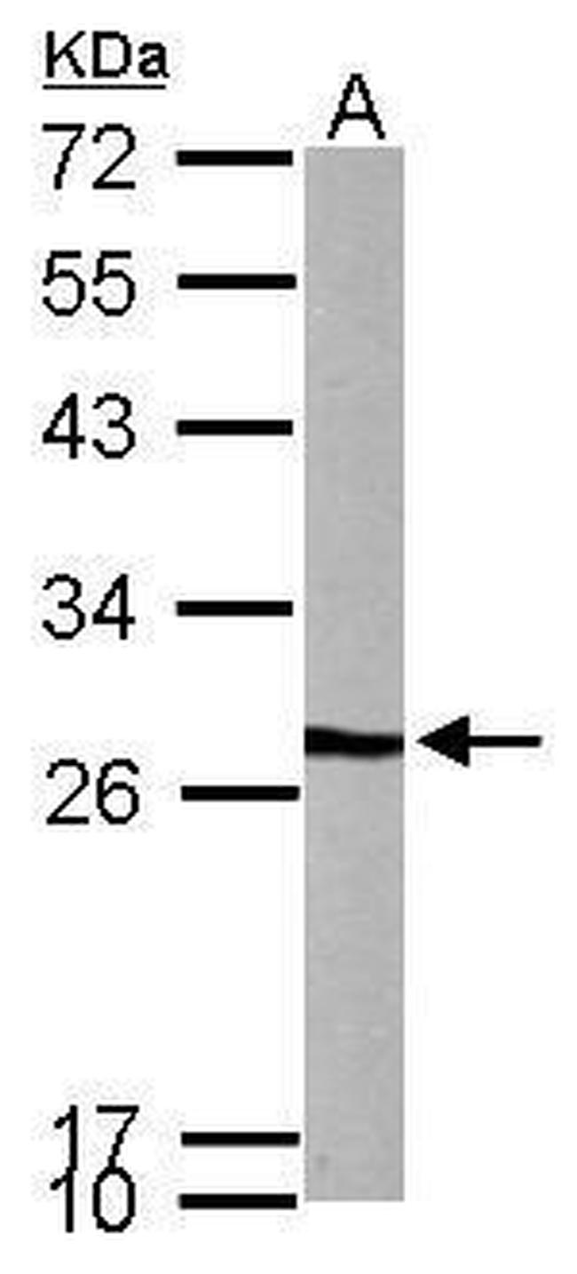 VBP1 Antibody in Western Blot (WB)