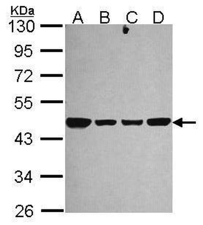 NDUFS2 Antibody in Western Blot (WB)