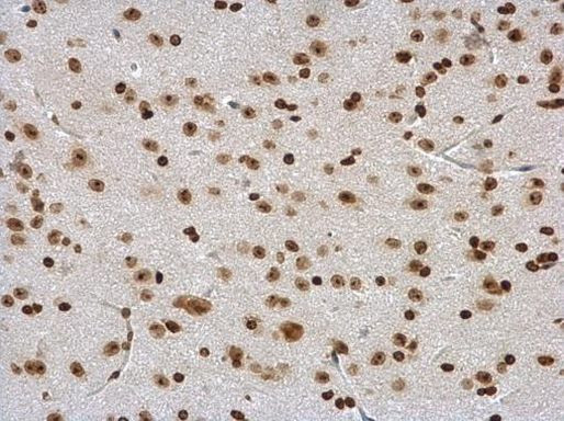 DDX56 Antibody in Immunohistochemistry (Paraffin) (IHC (P))