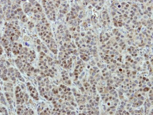 DDX56 Antibody in Immunohistochemistry (Paraffin) (IHC (P))