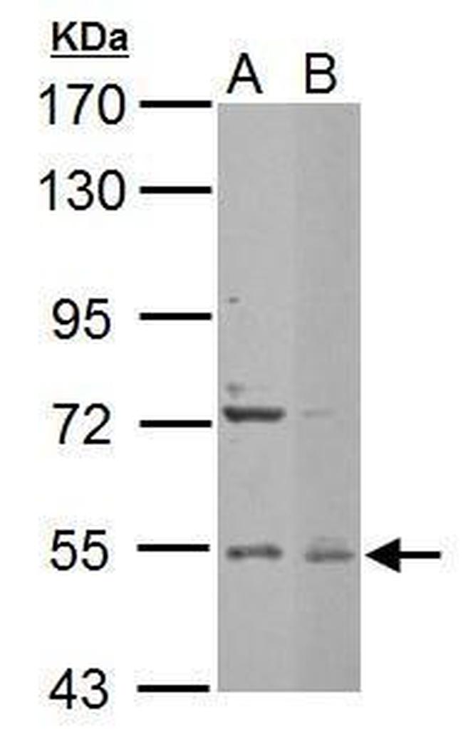 EDC3 Antibody in Western Blot (WB)
