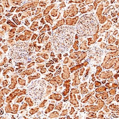 GPX3 Antibody in Immunohistochemistry (Paraffin) (IHC (P))