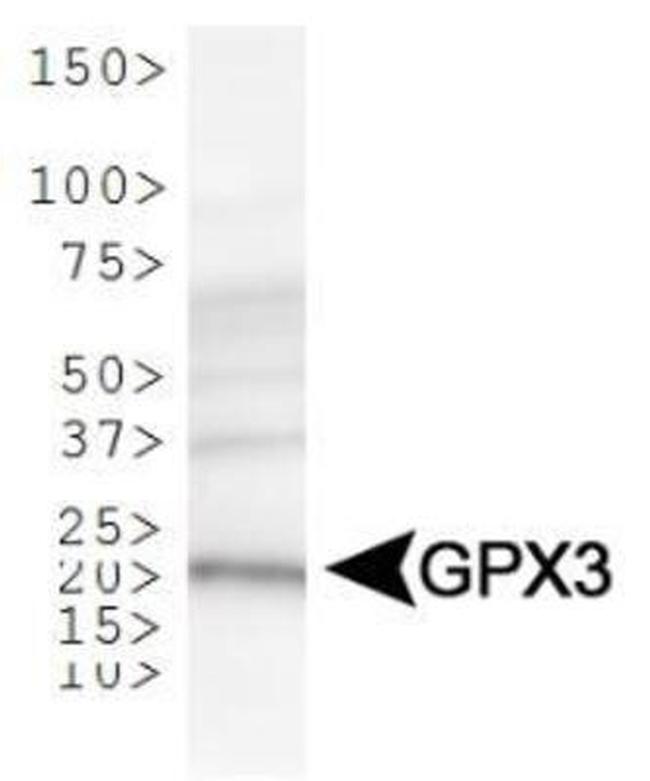 GPX3 Antibody in Western Blot (WB)