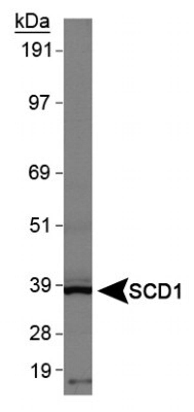 SCD Antibody in Western Blot (WB)