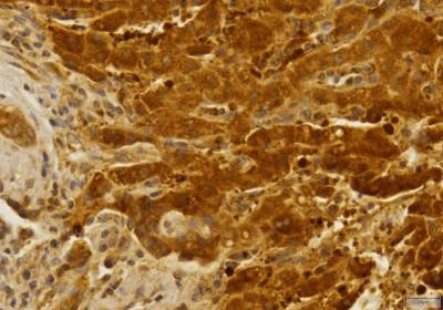 CCR2 Antibody in Immunohistochemistry (Paraffin) (IHC (P))