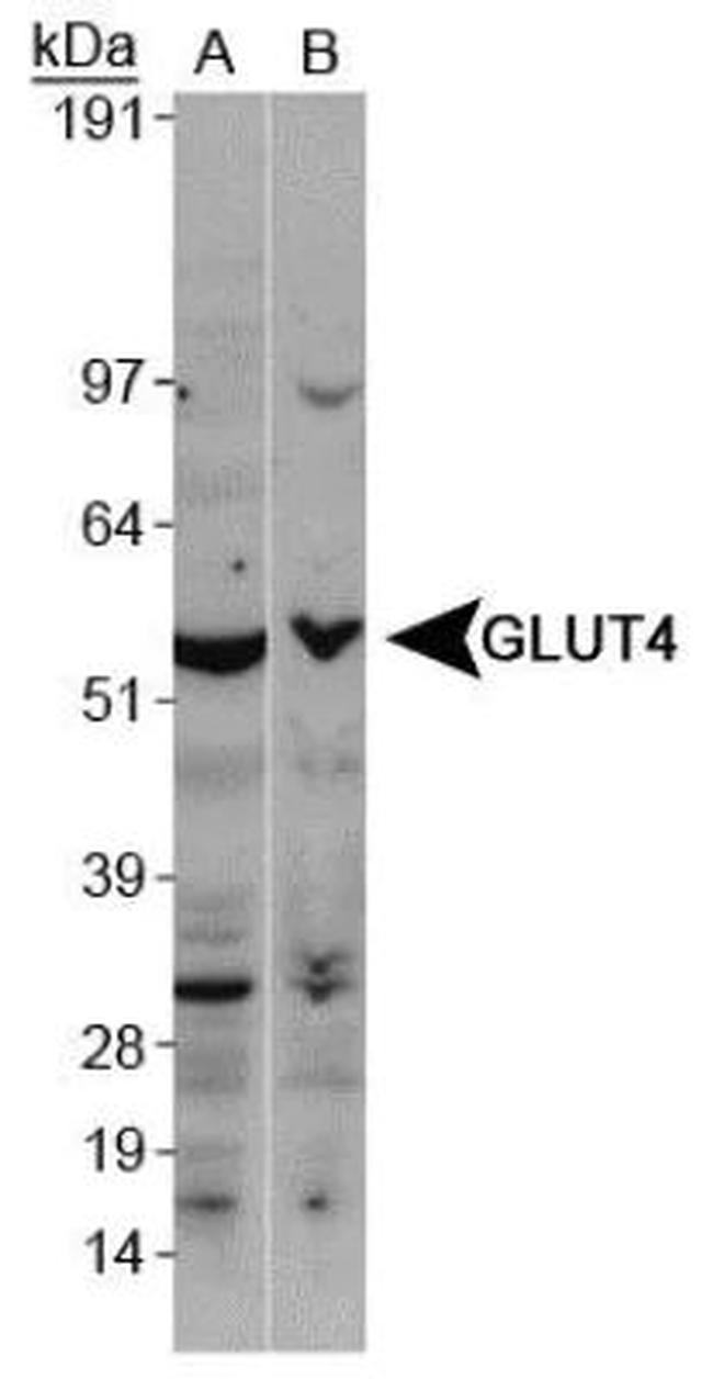 GLUT4 Polyclonal Antibody (PA5-23052)
