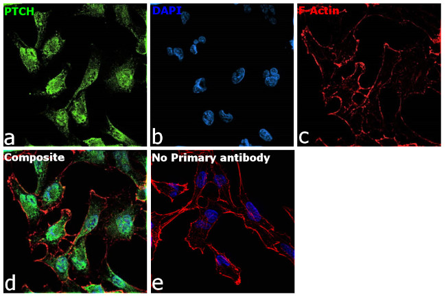 PTCH Antibody in Immunocytochemistry (ICC/IF)