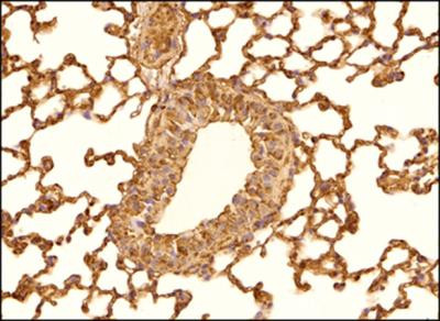 PTCH Antibody in Immunohistochemistry (Paraffin) (IHC (P))