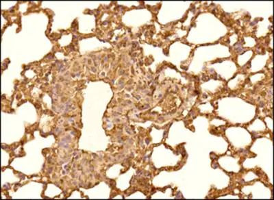 PTCH Antibody in Immunohistochemistry (Paraffin) (IHC (P))