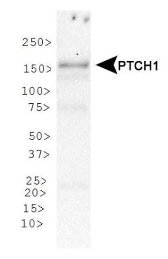 PTCH Antibody in Western Blot (WB)