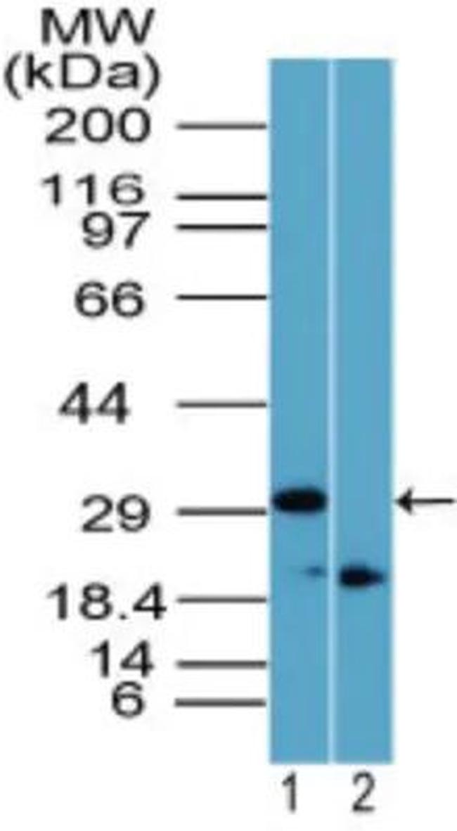 Rhox11 Antibody in Western Blot (WB)